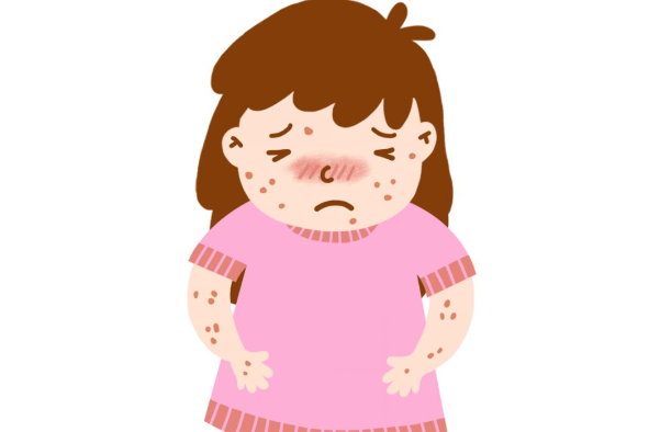 孩子又过敏了，咋办？