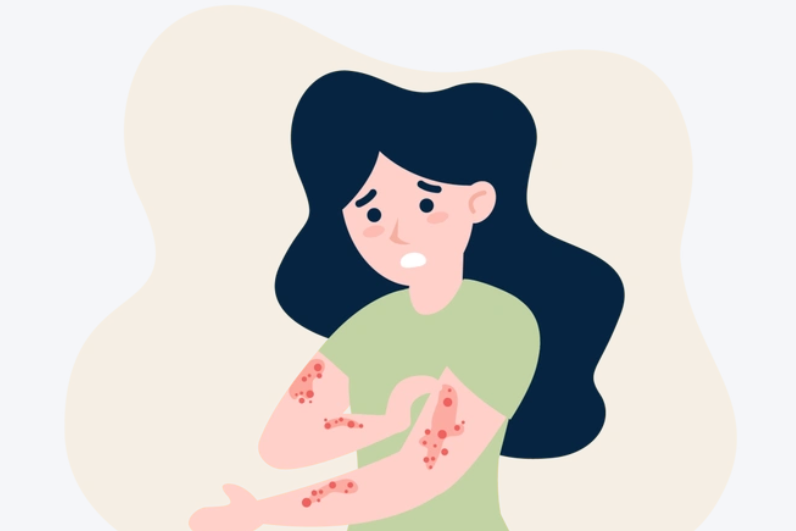 餐桌上的“抗敏药”